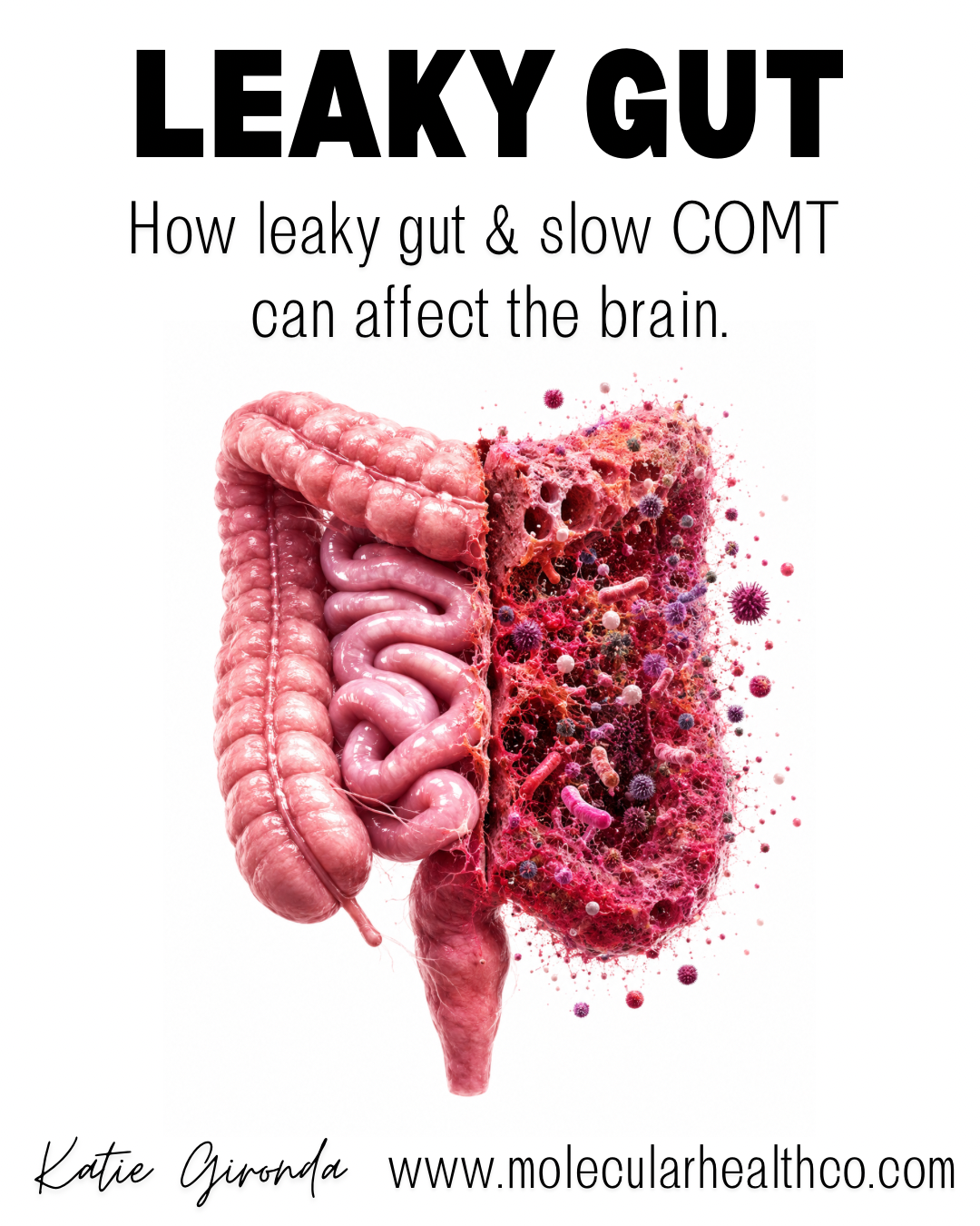 Leaky Gut and Slow COMT